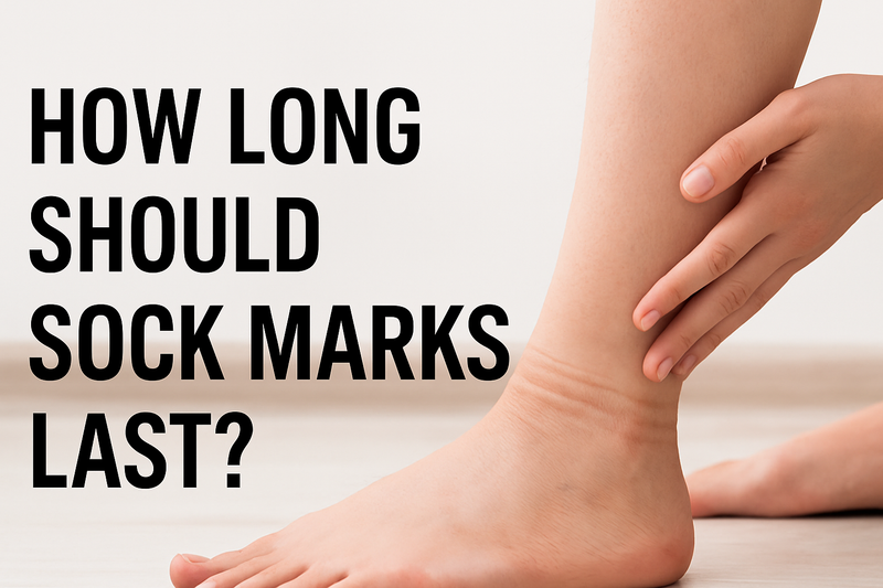 How Long Should Sock Marks Last
