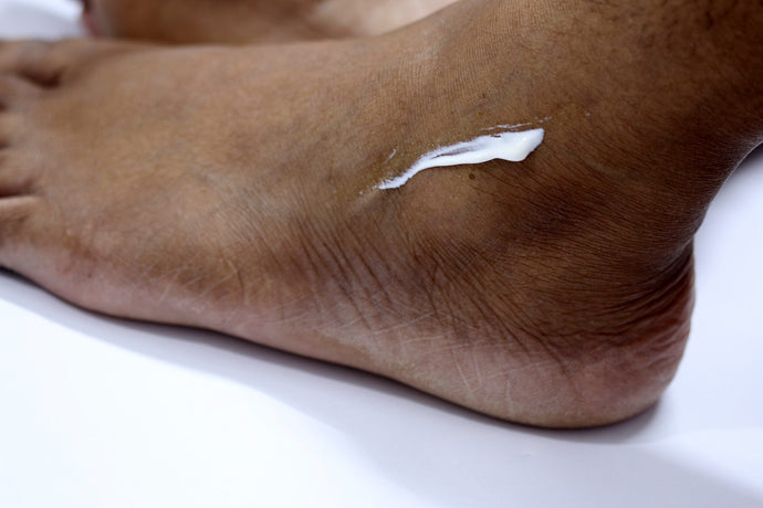 Magnilife Neuropathy Foot Cream Reviewed