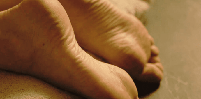Understanding Yellowing of the Bottom of Feet: A Comprehensive Guide