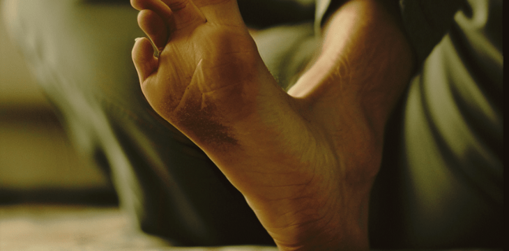 visible foot ulcer on the right sole