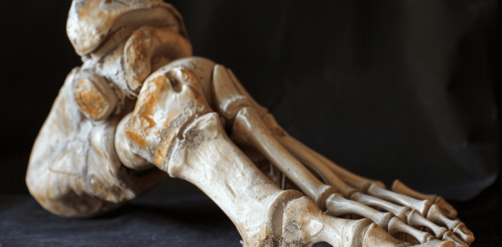 can diabetic foot charcot be reversed?