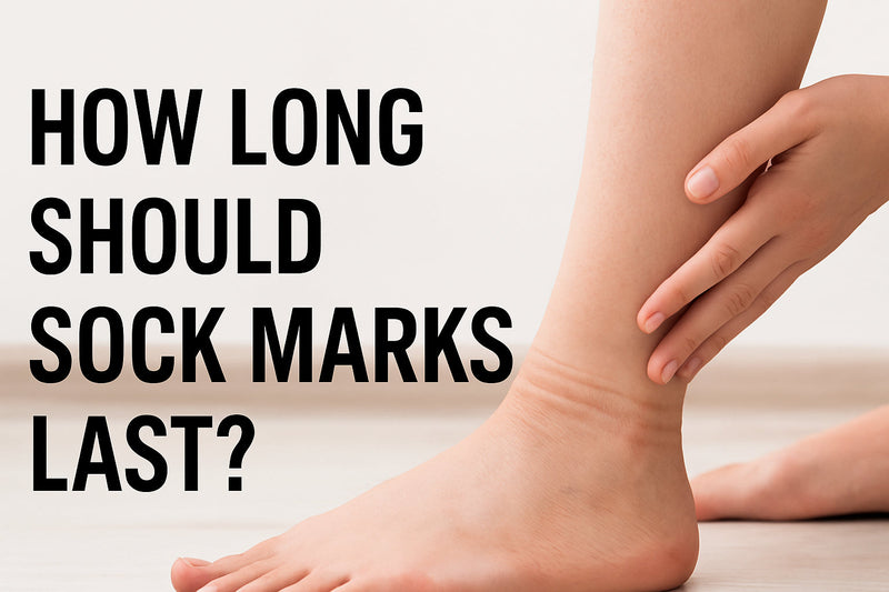 How Long Should Sock Marks Last