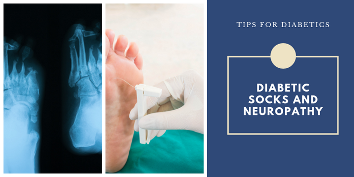 Can Diabetic Socks Help With Neuropathy?